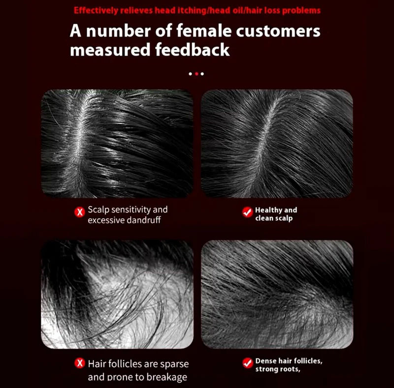 HairSpa Pro™ – Cepillo Masajeador de Cuero Cabelludo 3 en 1 | Luz Roja y Cuidado Anticaída