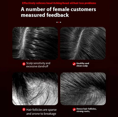 HairSpa Pro™ – Cepillo Masajeador de Cuero Cabelludo 3 en 1 | Luz Roja y Cuidado Anticaída